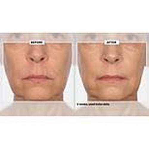 Signature Club A 5 Essentials Creme for Face and Eyes with Plant Stem Cell Complex