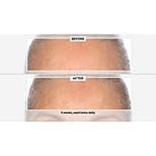 Signature Club A 5 Essentials Creme for Face and Eyes with Plant Stem Cell Complex
