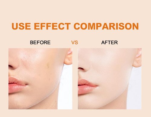 Regine Switzerland Vitamin C Brightening Facial Serum - Fade Dark Spots & Even Skin Tone (30ml)