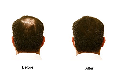 Hair Enhancer Spray for Thinning Hair & Volume - 5 oz (142 g) - Water-Resistant, Natural Color
