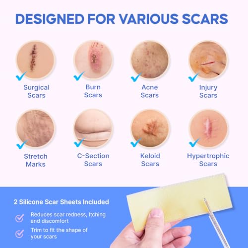 Medical Grade Silicone Scar Gel for Old & New Scars - Fade & Flatten, 30g with 2 Sheets