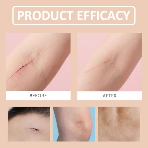 Silicone Scar Stick 2Pcs - Gentle, Lightweight & Easy to Apply for Face & Body