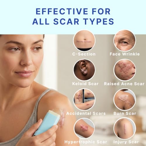 Silicone Scar Removal Stick for Face & Body - Keloid, Acne, C-Section, Stretch Marks - 20g