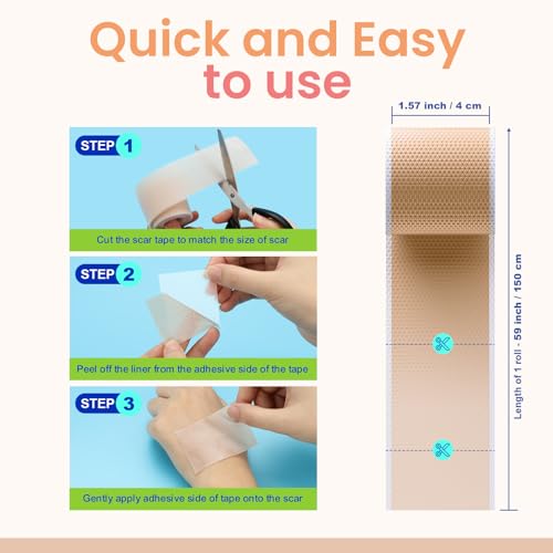 Silicone Scar Tape for Surgical & Keloid Scars, Reusable 1.6x60 Inch Roll