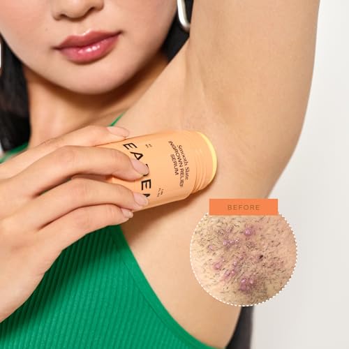 Ingrown Hair Serum & Roller for Razor Bumps & Dark Spots - Sensitive Skin Safe