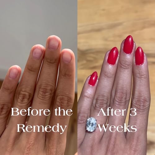 Nail Strengthening Polish for Damaged Nails - Poppy Red - Vegan & Plant-Based