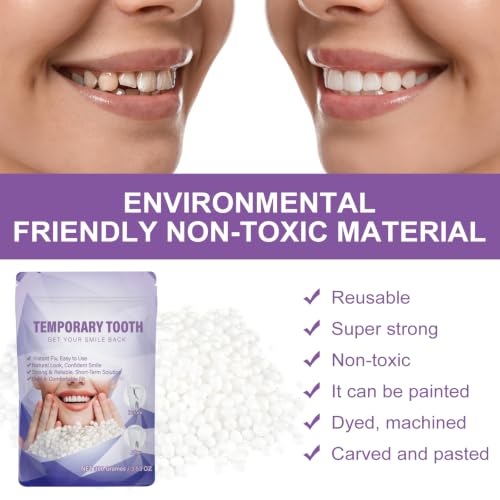 Tooth Repair Kit Moldable Beads for Emergency Dental Fixes - Safe & Durable