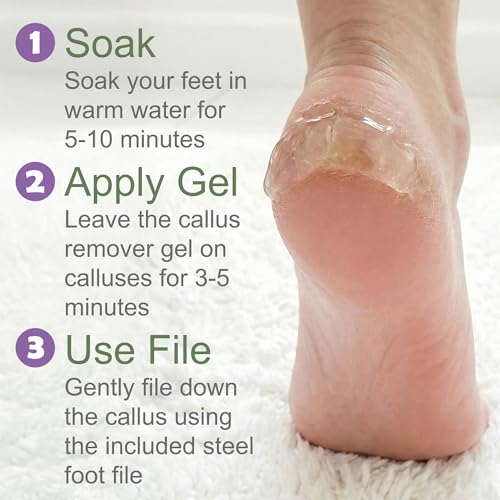 Foot Callus Remover Gel & File Set - 8 oz Extra Strength Callus Removal with Double Sided Foot File