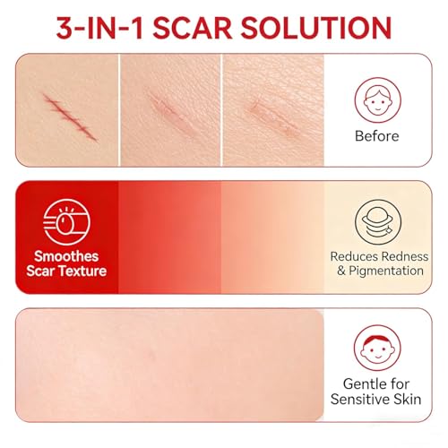 Scar Soothing Cream for Sensitive Skin - Reduces Redness & Improves Appearance