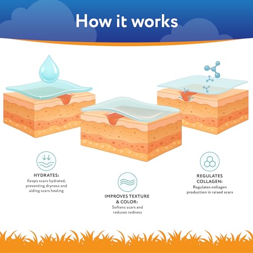 ScarAway Kids Silicone Scar Gel, 100% Medical-Grade, Helps Improve Size, Color & Texture of Hypertrophic & Keloid Scars on Face & Body from Injury, Burns & Surgery, Water Resistant, Clear, 6g