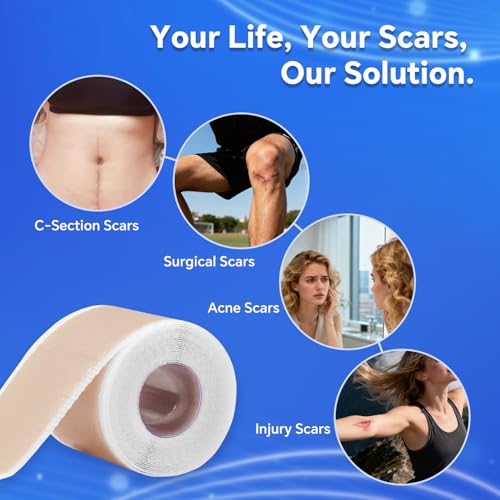 Reusable Silicone Scar Tape 1.5M - Skin Healing & Scar Minimize