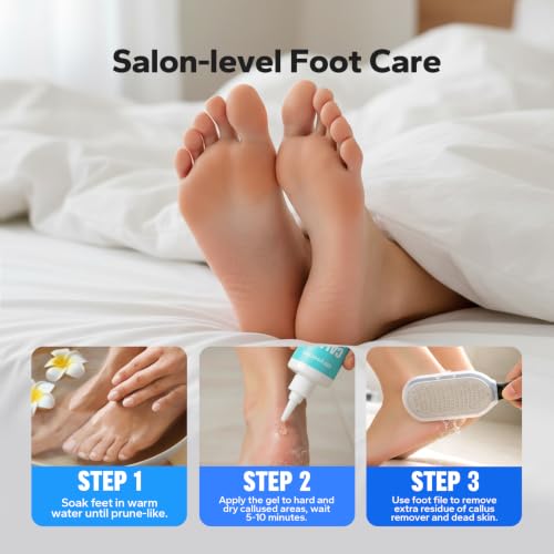 Callus Remover Gel for Feet - Extra Strength Foot Callus Removal & Softening Solution