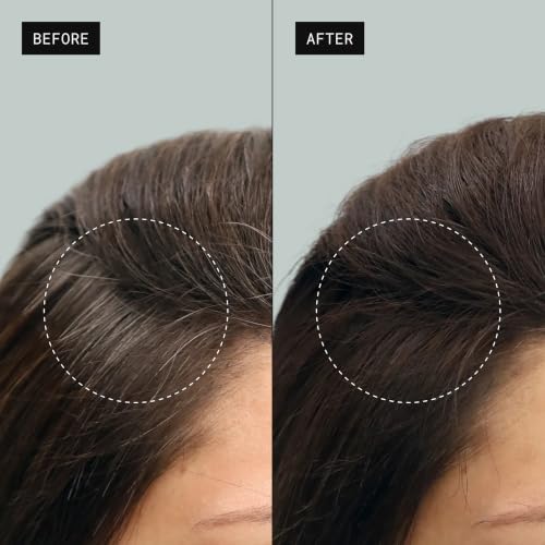 Toppik Colored Hair Thickener Hair Spray for Root Touchup - Black 5.1 oz