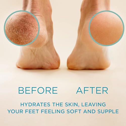 Unscented 8oz Callus Remover Gel for Feet - Extra Strength, Fast-Acting