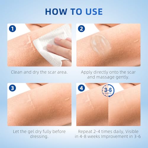 Transparent Silicone Scar Gel for Old & New Scars, Stretch Marks & Acne - 1.76 oz