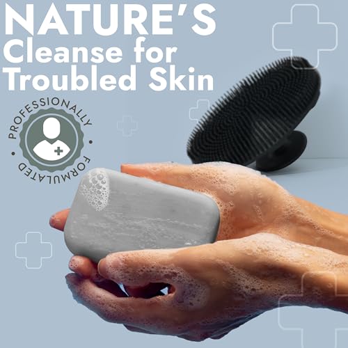 Antibacterial Body Bar Soap with Scrubber for Back Acne & Body Odor - 2 Pack