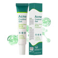 Regine Switzerland Azelaic Acid Serum 10% - Acne Treatment Gel with Salicylic Acid for Clear Skin | 1.7 oz