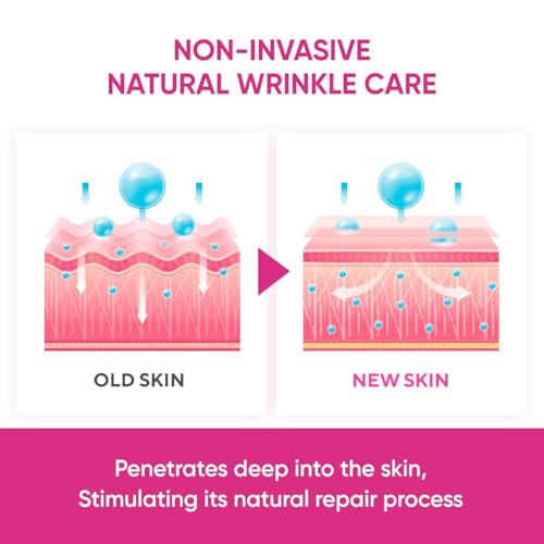 SILKDERMIS Facial Wrinkle Patches: Anti Wrinkle Facial Patches overnight- Forehead Wrinkles Treatment (Red(144 pcs))