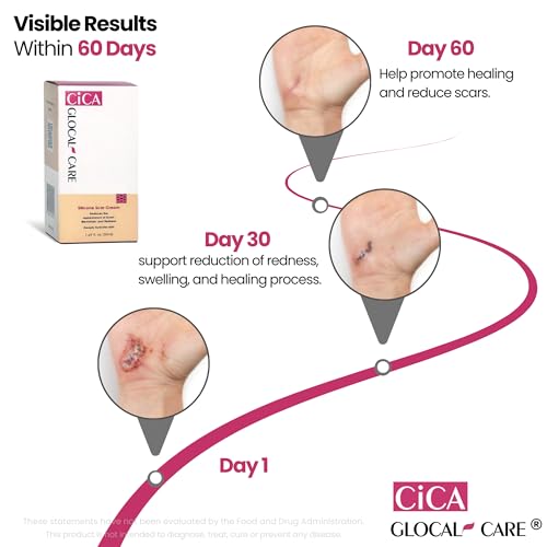 CICA Silicone Scar Cream for Scar & Stretch Mark Removal - 50ml