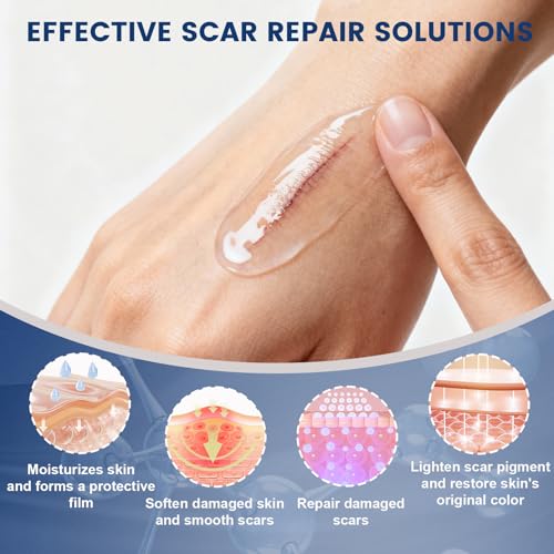 Silicone Scar Gel for Old & New Scars - Fast Absorbing & Gentle 1.7oz