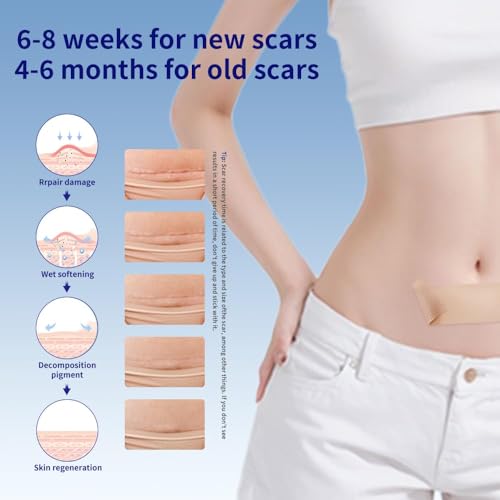 Silicone Scar Sheets 1.6x59 Inch Roll - Reusable Skin Scar Treatment Tape Beige