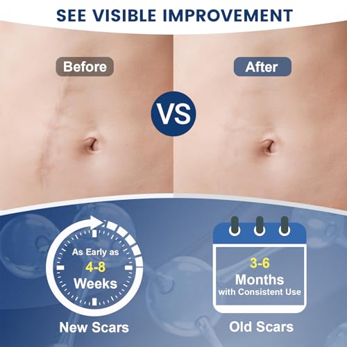Silicone Scar Gel for Old & New Scars - Fast Absorbing & Gentle 1.7oz