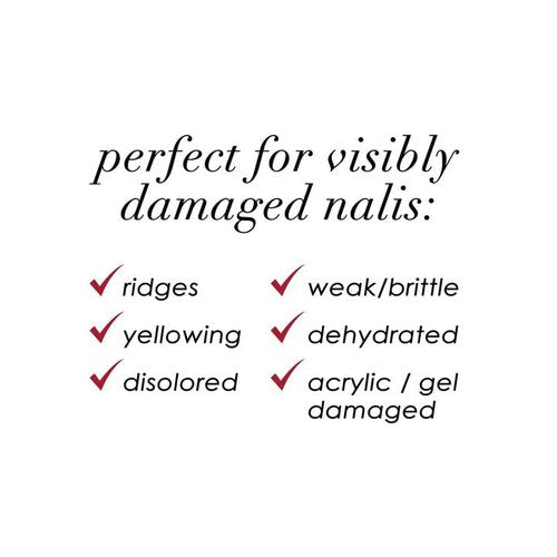 Dermelect MAKEOVER Smoothing Ridge Filler Mocha – Award-Winning Nail Treatment, Strengthens & Conceals Damaged, Brittle, Ridged, Peeling Nails – Base Coat & Nail Repair Formula 0.4 oz