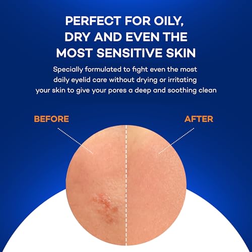 Natural Face Wipes for Makeup Removal & Gentle Exfoliation – 30 Count – Suitable for All Skin Types
