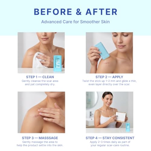 Silicone Scar Removal Stick for Face & Body - Keloid, Acne, C-Section, Stretch Marks - 20g