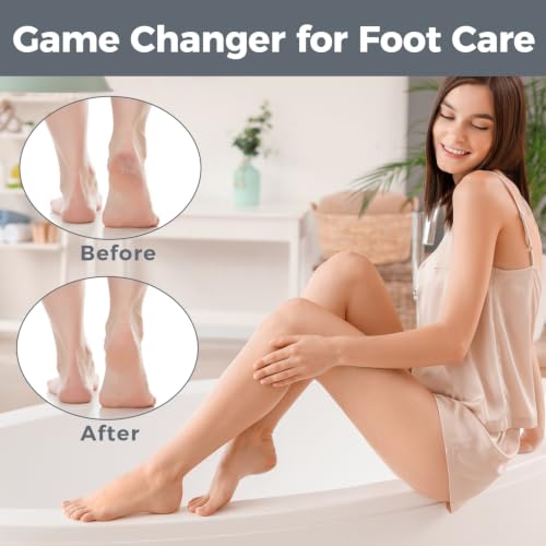 Foot File Callus Remover Pedicure Tool for Dead Skin Removal - Black