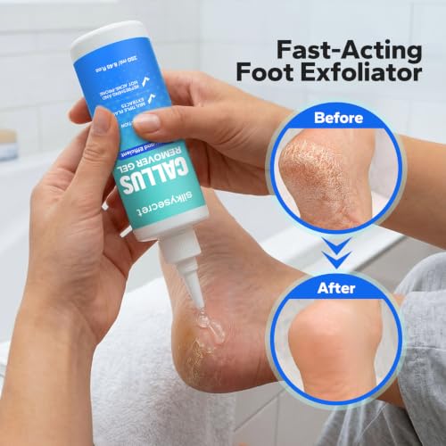 Callus Remover Gel for Feet - Extra Strength Foot Callus Removal & Softening Solution