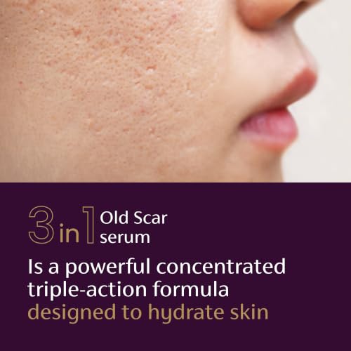 Scar Serum for Old Scars - Reduces Discoloration, Hydrates & Smooths Skin