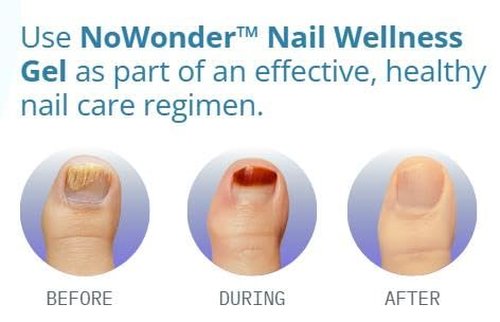NoWonder Nail Wellness Gel - Nitric Oxide Nail Renewal Solution for Healthier, Clearer Nails | Easy-to-Use, Non-Prescription Care