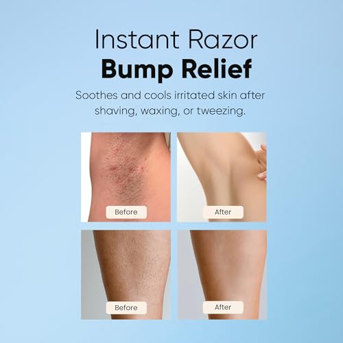 ESTETIST Razor Bump Stopper Roll-On for Ingrown Hairs & Dark Spots - Original