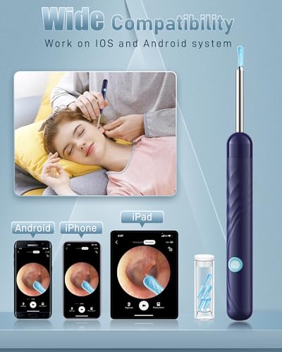 Deep Blue Ear Wax Removal Kit with Camera and Light - 1080P, Includes 6 Soft Spoons