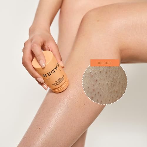 Ingrown Hair Serum & Roller for Razor Bumps & Dark Spots - Sensitive Skin Safe