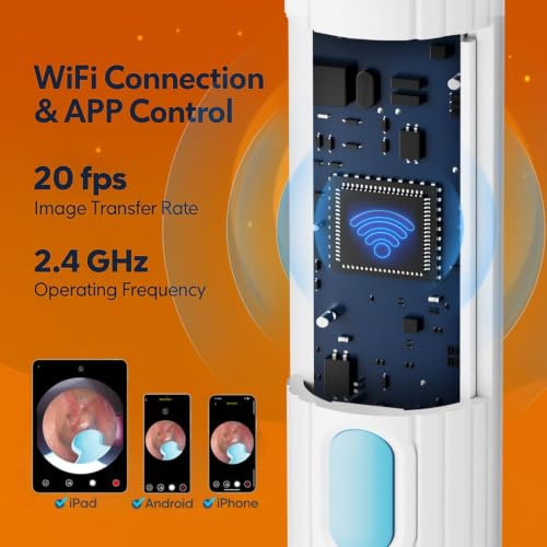 Ear Wax Removal Tool with Camera 1296P HD, Wireless Ear Scope Kit with 8 Tips - Cream Milky
