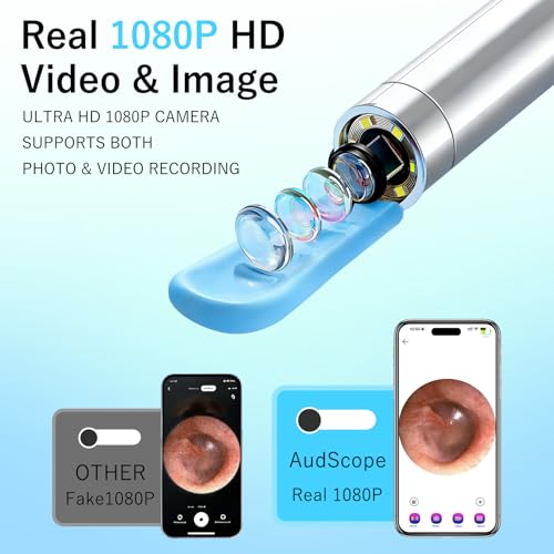 Ear Wax Removal Camera Tool with 1080P HD & 6 LED Lights - White