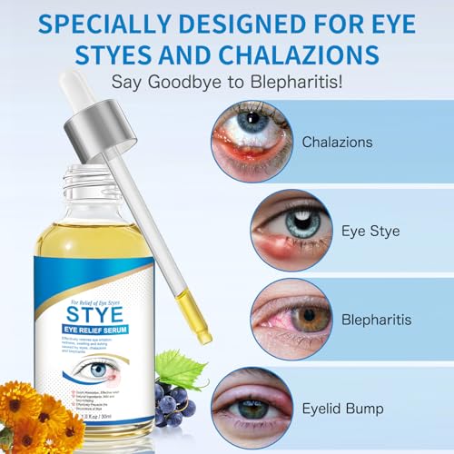 Stye Eye Treatment, Natural Stye Relief Serum for Styes, Chalazions and Blepharitis, Quickly Relieves Eye Irritation and Restores Healthier Skin,30ML