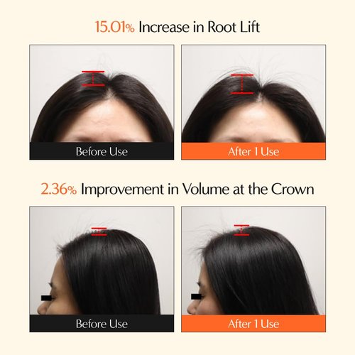 Lilyeve GrowTurn 3D Volume Shampoo - Built-In Brush for Thinning Hair & Fuller Volume | 6.76 Fl Oz