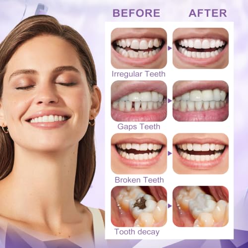 Tooth Repair Kit Moldable Beads for Emergency Dental Fixes - Safe & Durable