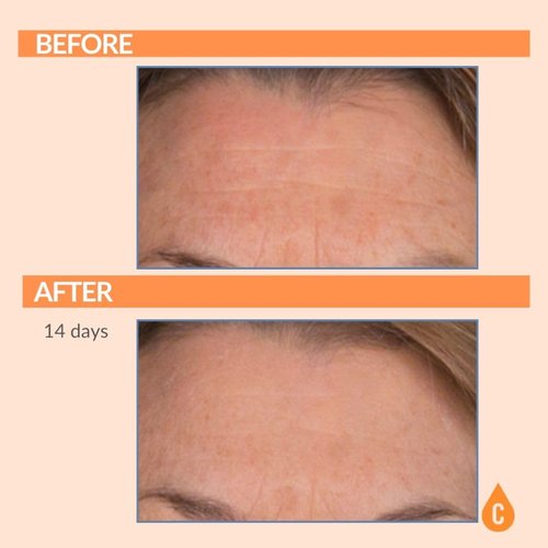 Serious Skincare - Serious-C3 Plasma Vitamin C Restore - Restoration Night Cream for Deep Hydration - Hydrolyzed Collagen - Hydrating Moisture for Face and Neck - 1.7 oz.