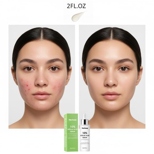 10% Azelaic acid Serum for face Inspired By Korean Skincare K Beauty Azalecic Acid Acido Azelaico Redness Soothing Serum with Azaleic acid, Hyaluronic Acid, Niacinamide, Spot Care(2FL.OZ/60 ML)