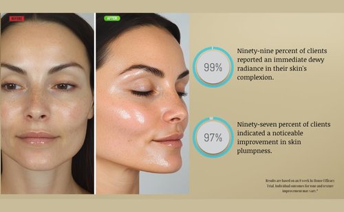 Regine Switzerland Hyaluronic Acid Serum - Hydrating Anti-Aging Formula with Vitamin B5 | Smooth & Plump Skin