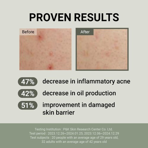 JUMISO Snail Mucin 88 Peptide Cream - Korean Face Moisturizer 5-Peptide Complex Collagen Boost Hyaluronic Acid Niacinamide Damaged Skin Repair - Sensitive Skin Non-Comedogenic 3.38 oz.