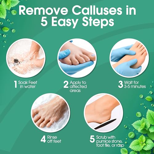 Foot Callus Remover Kit with Mint Gel, Rasp & File for Home Pedicure