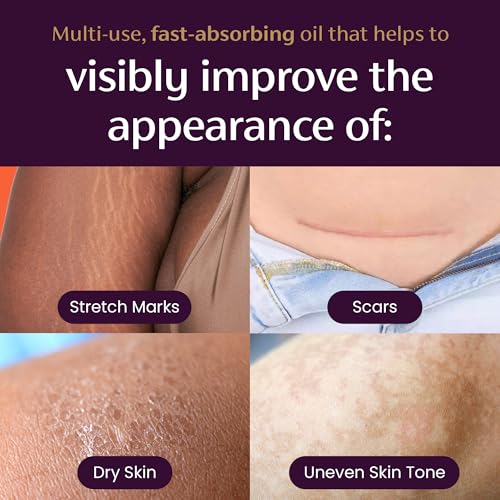 Mederma Quick Dry Scar and Stretch Mark Body Oil 3.4 Fl Oz