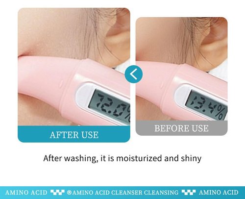 Skiennix Acid Facial Cleansing Mousse - Gentle Hydrating Foaming Face Wash | 2.1 FL.OZ