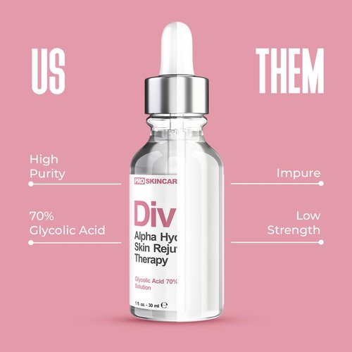 Glycolic Acid Peel 70% | Professional At-Home Chemical Peel for Acne Scars & Wrinkles - Liquid Exfoliant