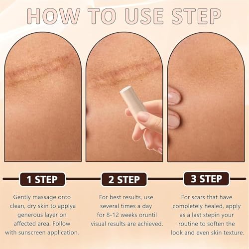Silicone Scar Stick 2Pcs - Gentle, Lightweight & Easy to Apply for Face & Body
